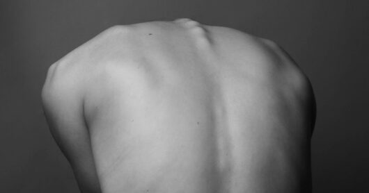 Left Neck and Mid-Back Pain